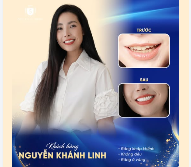 TỪ NỤ CƯỜI MẤT ĐIỂM ĐẾN CHIẾM TRỌN MỌI ÁNH NHÌN