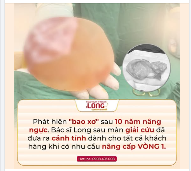 10 NĂM TRƯỚC, CHỊ ĐÃ CHỌN DÒNG TÚI NÀY VÀ… ĐIỀU ĐÁNG TIẾC ĐÃ XẢY RA