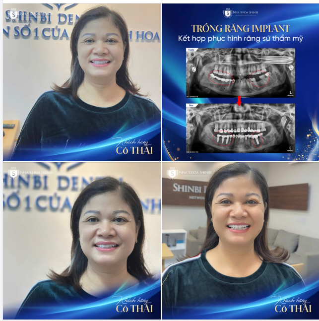 U50 ĂN NGON CƯỜI ĐẸP SAU 6 NĂM GHÉ SHINBI