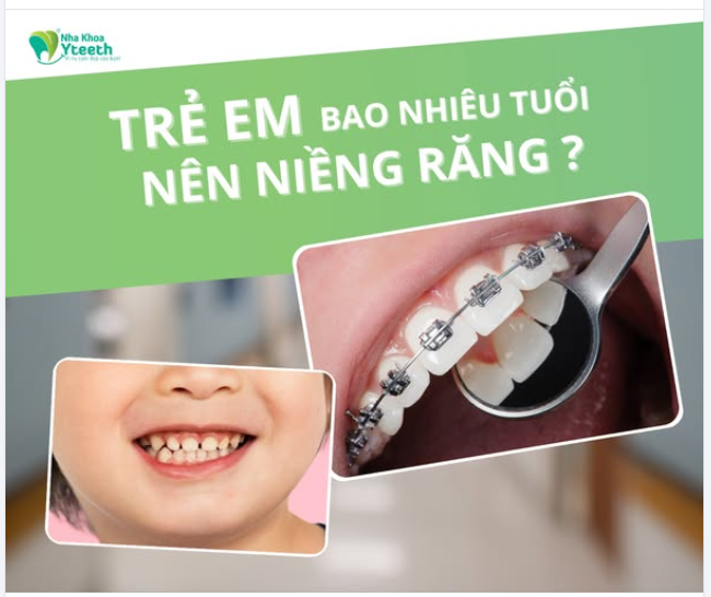 ĐỘ TUỔI PHÙ HỢP ĐỂ NIỀNG RĂNG CHO TRẺ MÀ PHỤ HUYNH CẦN BIẾT!