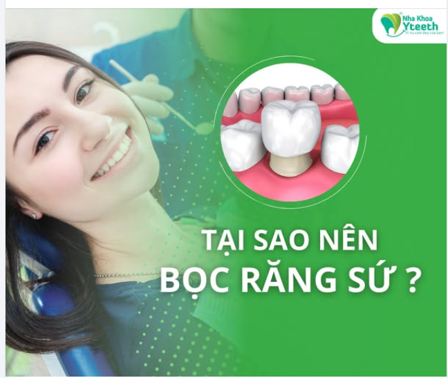 BẠN MUỐN SỞ HỮU NỤ CƯỜI ĐẸP? RĂNG SỨ LÀ LỰA CHỌN HOÀN HẢO!