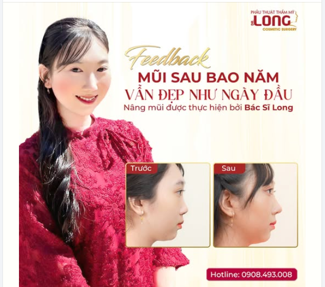 MŨI SAU BAO NĂM VẪN ĐẸP NHƯ NGÀY ĐẦU