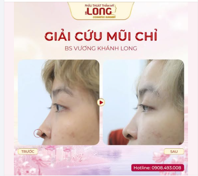 “NGHE” KHÔNG CHƯA ĐỦ - CẦN PHẢI NHÌN “THẤY” MỚI BIẾT THỰC HƯ NHƯ THẾ NÀO?