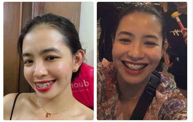 Hãy coi mỗi buổi sáng là cơ hội để "ĐIỀU CHỈNH" bản thân, như những chiếc mắc cài dần đưa bạn đến mục tiêu.