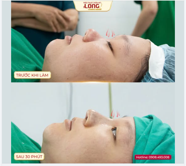 Chị ơi em sợ…  Chị ơi có đau lắm không…  Chị ơi lát chị vô nắm tay em nha…  Chị ơi sao mà em run quá trời rồi…