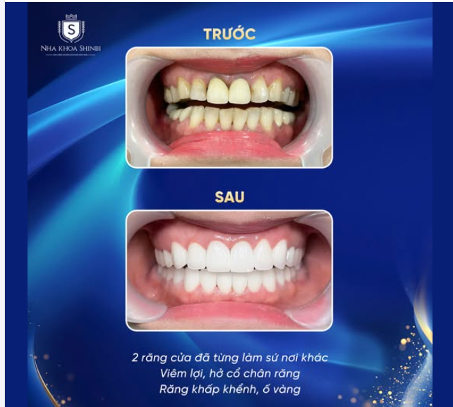 NỮ KHÁCH HÀNG LÀM TRONG NGÀNH GIÁO DỤC TÌM ĐẾN SHINBI ĐỂ "CỨU NGUY" NỤ CƯỜI