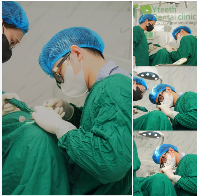 Để trồng được 1 chiếc implant cần đỏi hỏi bác sĩ phải có một sự chuẩn bị kỹ lưỡng và tỉ mỉ để quá trình trồng implant diễn ra thành công và thuận lợi.