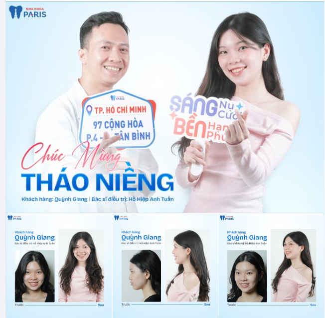 CHỌN NIỀNG RĂNG - CHỌN MỘT HÀNH TRÌNH RỰC RỠ HƠN CHO CHÍNH MÌNH!