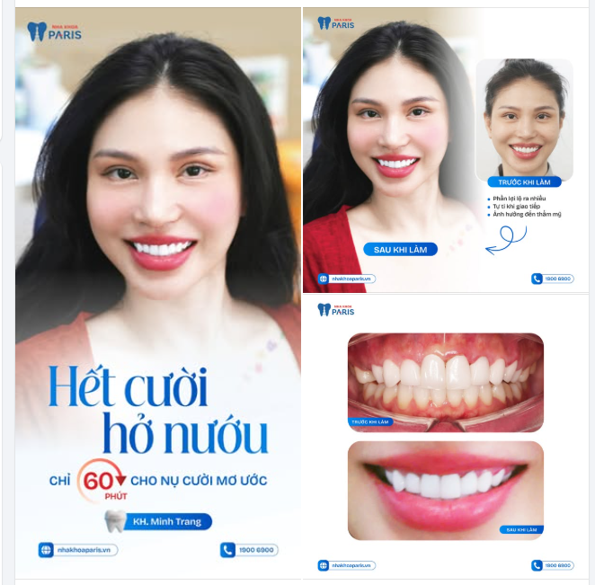 Chỉ một thay đổi nhỏ… mà rạng ngời thấy rõ