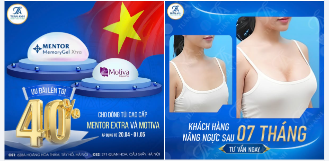 Sẵn sàng đón lễ – “tân trang” vóc dáng cực xinh !  Kỳ nghỉ dài sắp tới, các chị em đã có kế hoạch làm đẹp gì chưa?