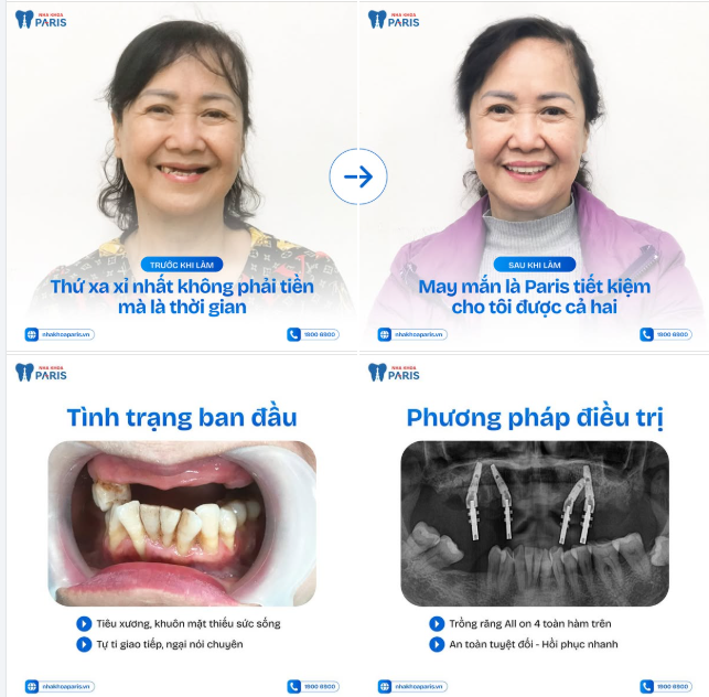 "Ở tuổi này, thứ xa xỉ nhất không phải tiền – mà là thời gian  May mắn là Paris tiết kiệm cho tôi được cả hai"