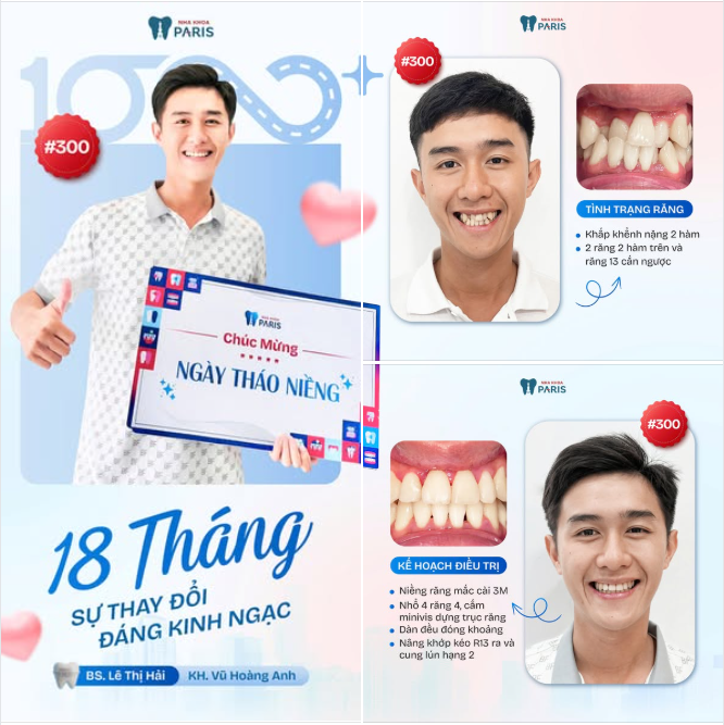 HÀNH TRÌNH NIỀNG TUYỆT VỜI 300