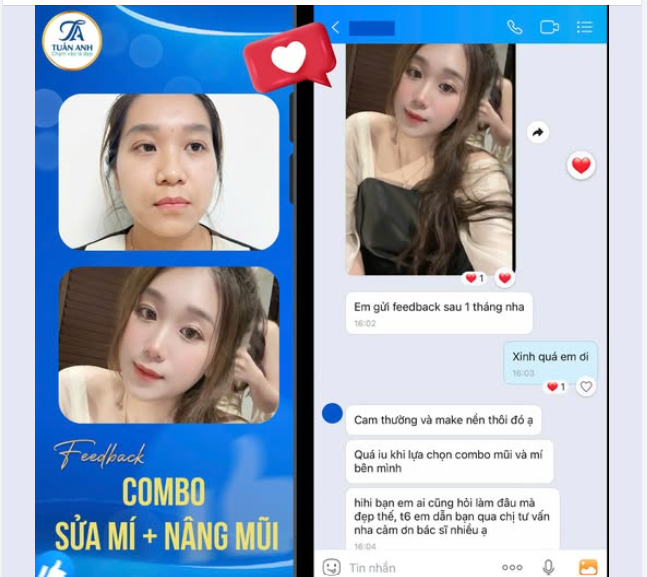 QUÁ YÊU KHI CHỌN COBO MÍ MŨI