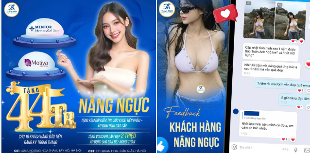 NÂNG CẤP VÒNG 1 CÔNG NGHỆ MỚI NHẤT