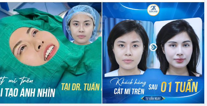 Một đôi mắt đẹp, ánh nhìn thu hút tạo sự tự tin trong giao tiếp và cuộc sống