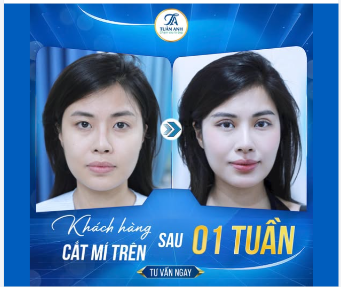 Mí xinh thu hút mọi ánh nhìn, nâng tầm tự tin