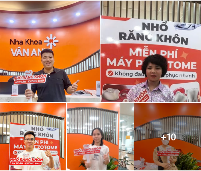 Tại sao hơn hàng ngàn khách hàng lựa chọn nhổ răng khôn tại Nha Khoa Vân Anh?