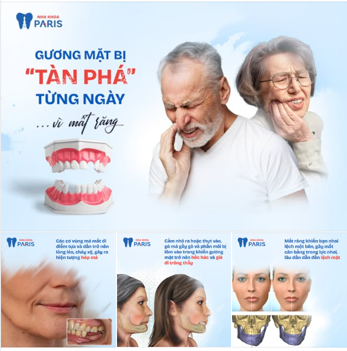 GƯƠNG MẶT BỊ “TÀN PHÁ” TỪNG NGÀY… CHỈ VÌ MẤT RĂNG