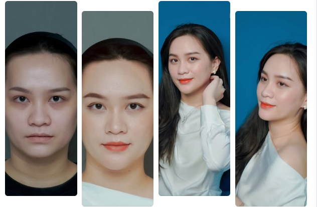 TỪ GƯƠNG MẶT HỐC HÁC, GIÀ TRƯỚC TUỔI ​​​​​​​ BIẾN HÓA THÀNH KHUÔN MẶT MỀM MẠI, CUỐN HÚT CHỈ VỚI 1 PP THẨM MỸ
