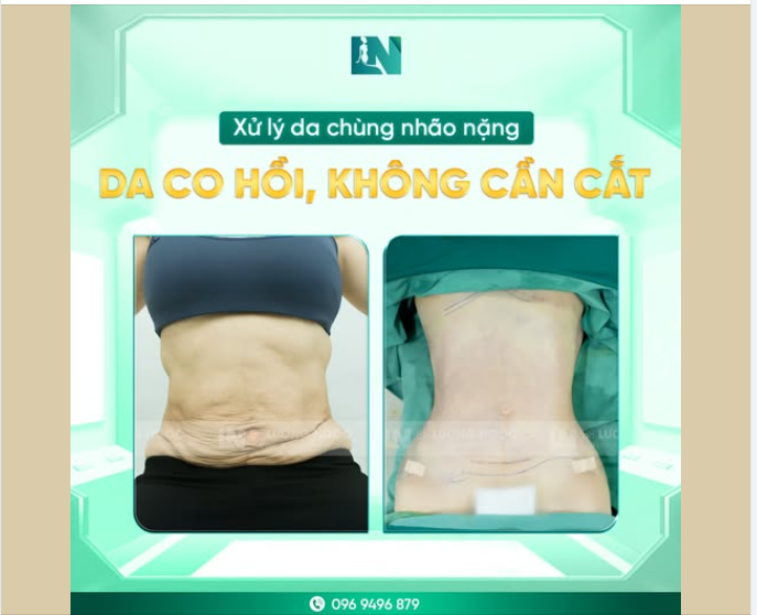 DA CHẢY KHÔNG SỢ - CO HỒI MƯỢT NHƯ MƠ!