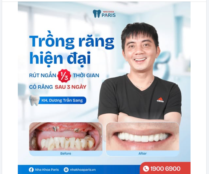 Trồng răng hiện đại  Rút ngắn 1/3 thời gian Có răng sau 3 ngày