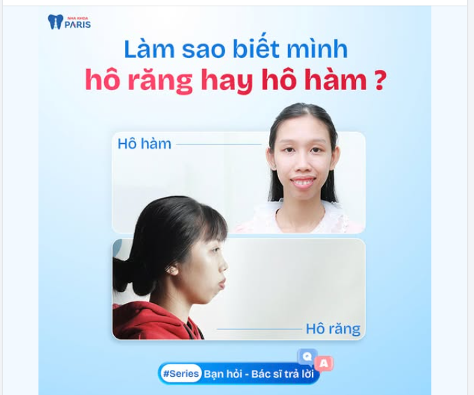 LÀM SAO ĐỂ BIẾT MÌNH HÔ DO RĂNG HAY HÔ HÀM?