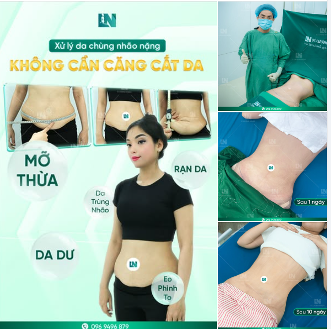 DA CHÙNG NHÃO NẶNG ĐỪNG VỘI CẮT BỎ