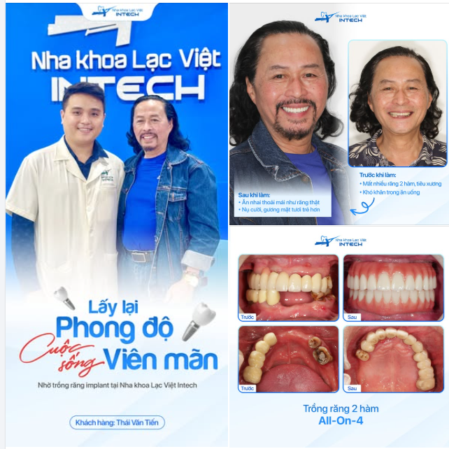 TRỒNG RĂNG ĐÚNG LÚC - ĂN NGỦ NGON GIẤC - HẠNH PHÚC DÀI LÂU
