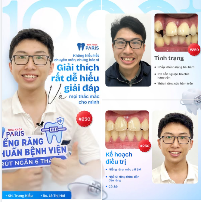 HÀNH TRÌNH NIỀNG TUYỆT VỜI 250
