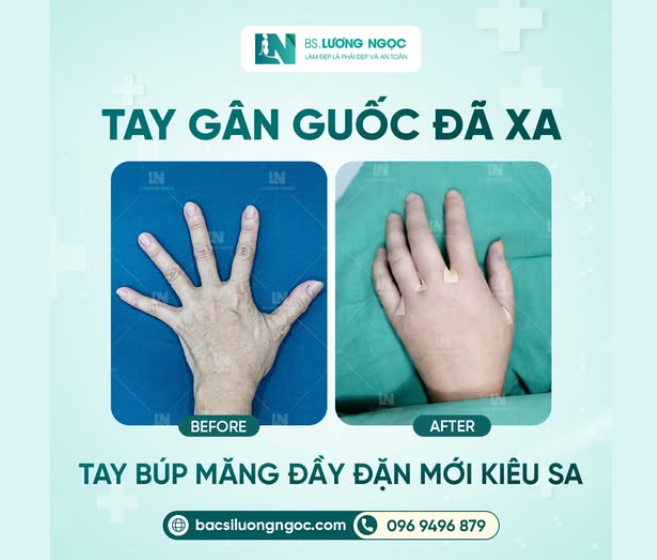 TAY GÂN GUỐC ĐÃ XA - TAY BÚP MĂNG ĐẦY ĐẶN MỚI KIÊU SA