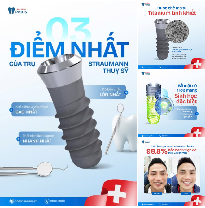 3 ĐIỂM  "NHẤT" CỦA TRỤ STRAMANN THỤY SỸ