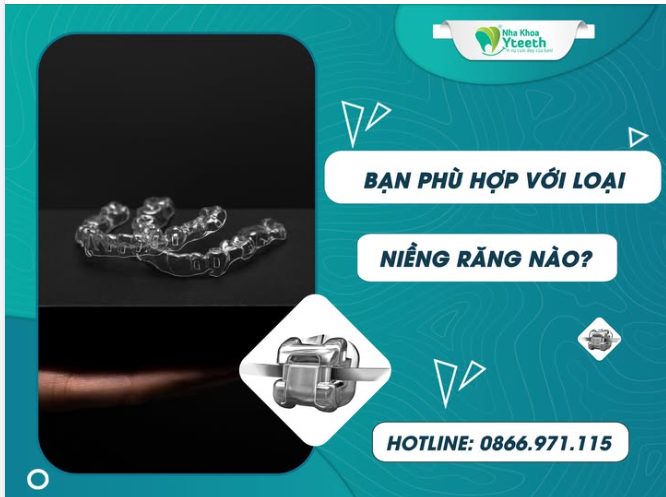 Bạn phù hợp với loại niềng răng nào? Niềng răng trong suốt Invisalign – Đỉnh cao thẩm mỹ & linh hoạt?