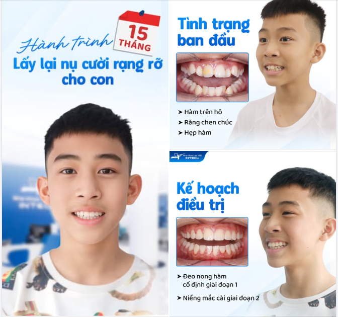 Hành trình 15 tháng tìm lại nụ cười rạng rỡ cho Việt Phong.