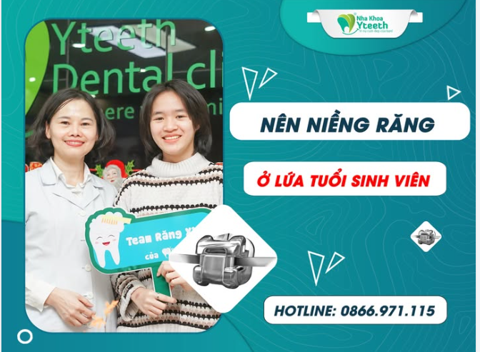 Nên niềng răng bây giờ hay chờ đi làm rồi mới làm đẹp?