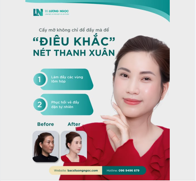 CẤY MỠ – KHÔNG CHỈ LÀ LÀM ĐẦY, MÀ LÀ “ĐIÊU KHẮC” THANH XUÂN