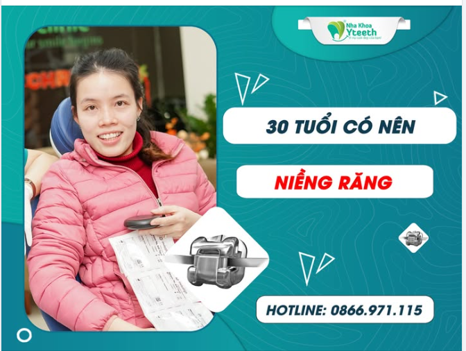 Ngoài 30 có nên niềng răng không?