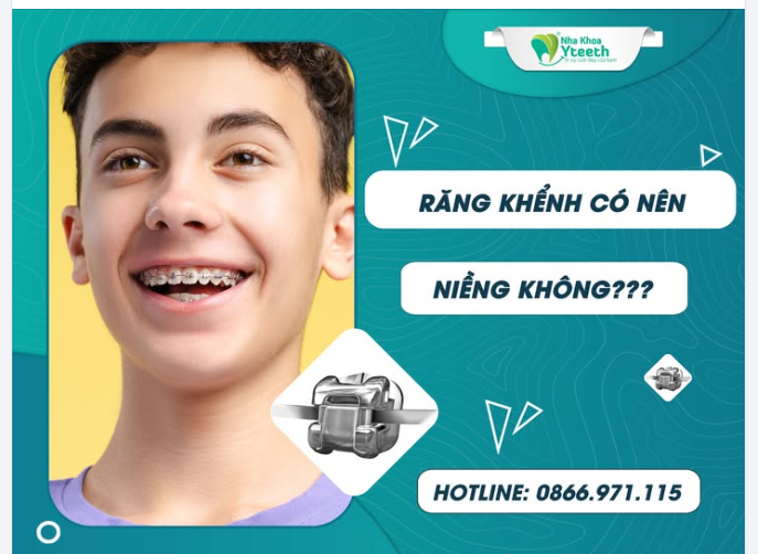 RĂNG KHỂNH CÓ NÊN NIỀNG KHÔNG?