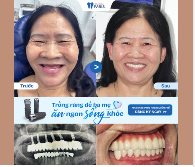 Răng rụng mất vài cái, nhưng ba mẹ cứ bảo “quen rồi, có sao đâu...”