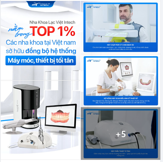 CÔNG NGHỆ VƯỢT TRỘI – BIẾN CẤY GHÉP IMPLANT TRỞ THÀNH MỘT TRẢI NGHIỆM NHẸ NHÀNG