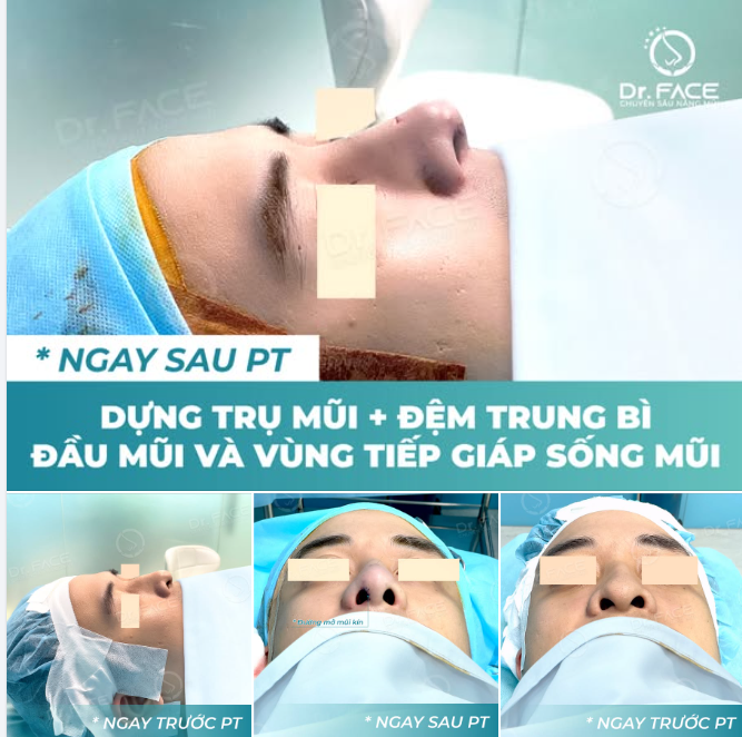 CA BẠN NAM NÀY RẤT ĐẶC BIỆT