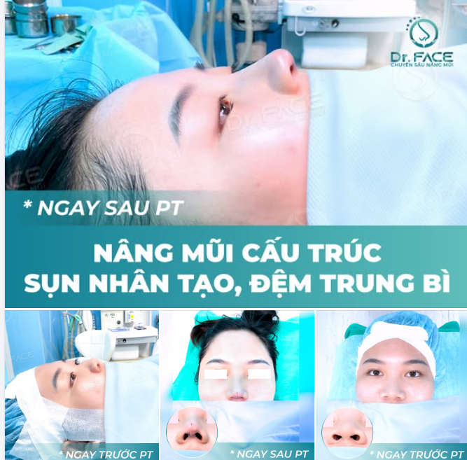 Đằng sau mỗi ca phẫu thuật thành công không chỉ là thay đổi diện mạo, mà còn là hành trình chạm đến phiên bản tự tin và rạng rỡ hơn của chính mình.