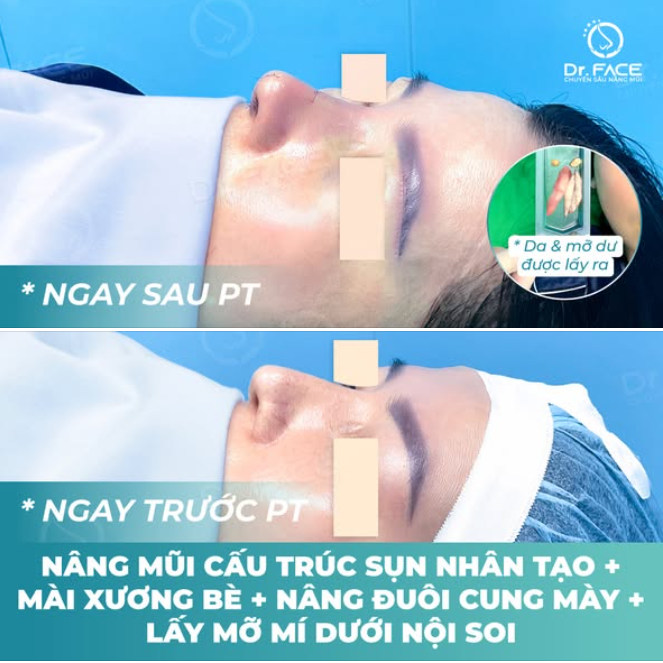 Lợi ích khi chọn COMBO DỊCH VỤ tại DR.FACE