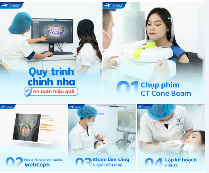 QUY TRÌNH CHỈNH NHA AN TOÀN , HIỆU QUẢ TẠI LẠC VIỆT INTECH
