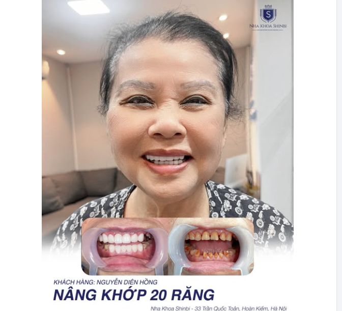 DÀNH TẶNG BẢN THÂN NỤ CƯỜI RẠNG RỠ NHẤT