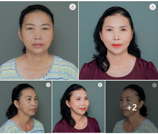 CẢI THIỆN KHUYẾT ĐIỂM ĐÔI MẮT - THAY ĐỔI CẢ THẦN THÁI KHUÔN MẶT!