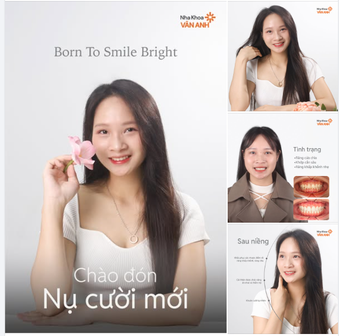 Đẹp tự nhiên nhưng không tự nhiên mà đẹp - Chào đón nụ cười mới tự tin rạng rỡ!