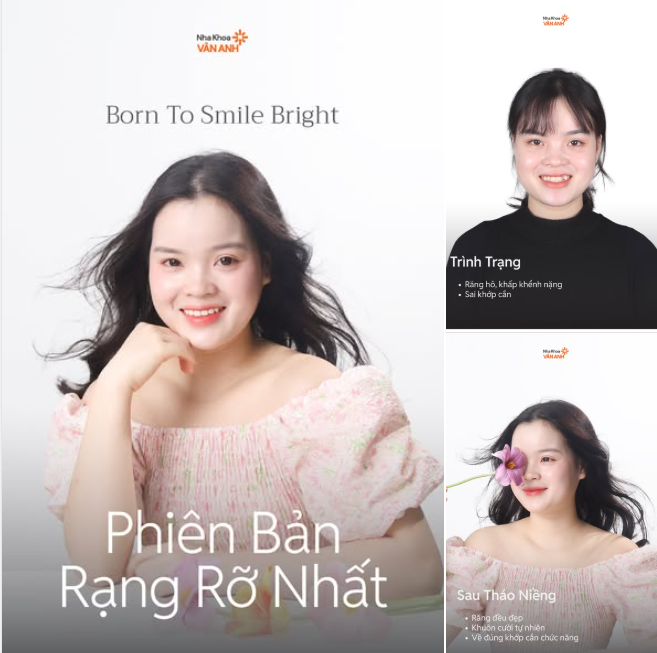 Có những cuộc thay đổi không chỉ chạm vào nụ cười — mà “sắp xếp lại” cả sự tự tin.