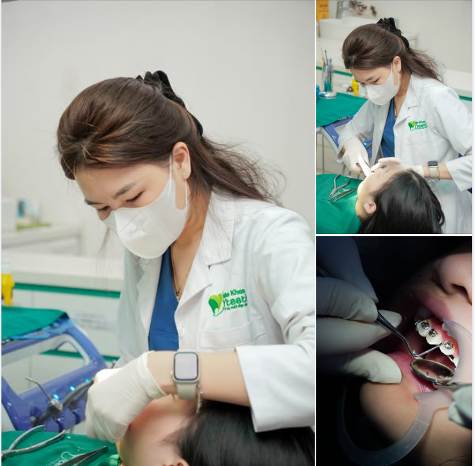 1 đồng niềng gia nhập Team bác sĩ Quỳnh