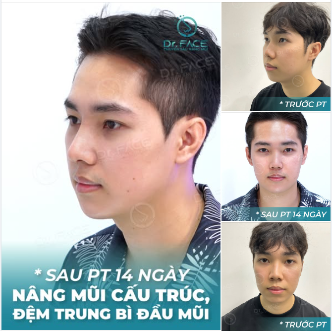 CHỐT BÁC PHƯƠNG CHỈ SAU 1 CLIP DUY NHẤT