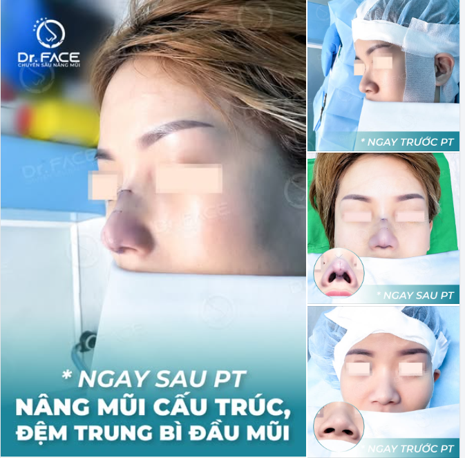 Cô bạn ở Đài Loan này đã biết đến bác sĩ từ 6 năm trước, nhưng vẫn chần chừ mãi vì nỗi sợ trong lòng.